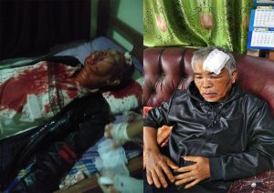 Penganiaya Normal Tambunan dan Anaknya Belum Tersentuh Hukum, Polres Taput Segera Gelar Perkara