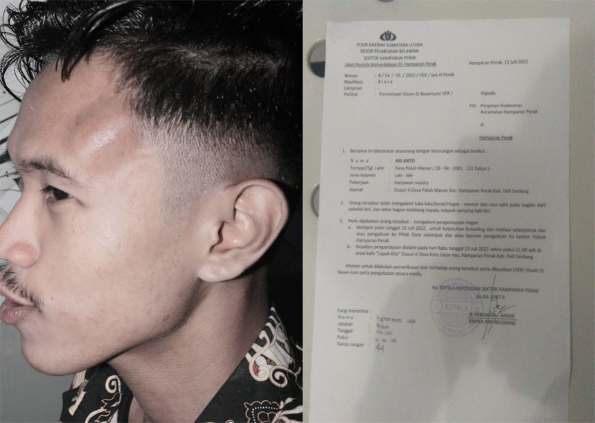 Dipukul
