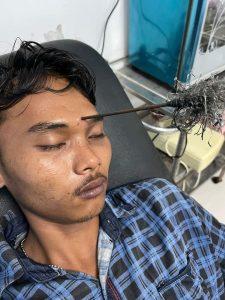 Belawan Mencekam, Kepala Korban Tawuran Tertancap Panah