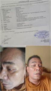 Pelaku UMKM Dibantai Ketua OKP, AKP Irwanta Sembiring: Kasusnya Kita Proses