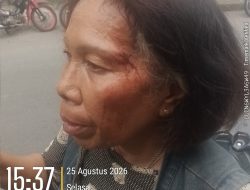Diduga Alami Penganiayaan di Depan Tiara Convention Center, Emperi Lince Silitonga Melapor ke Polrestabes Medan