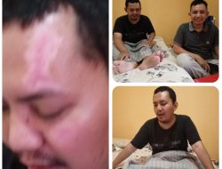 Enam Bulan Berlalu, Korban Kecelakaan BMW BK 333 Masih Terbaring: “Kami Menunggu Keadilan”