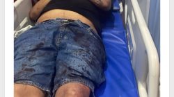 Doni Pak Cek Diduga Ditembak OTK di Tanjung Morawa, Mobil Oleng hingga Hantam Pedagang 3 IMG 20261019 WA0079