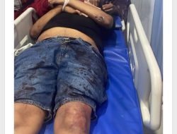 Doni Pak Cek Diduga Ditembak OTK di Tanjung Morawa, Mobil Oleng hingga Hantam Pedagang
